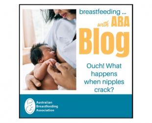 Breastfeeding .. with ABA blog. Ouch! What happens when nipples crack?