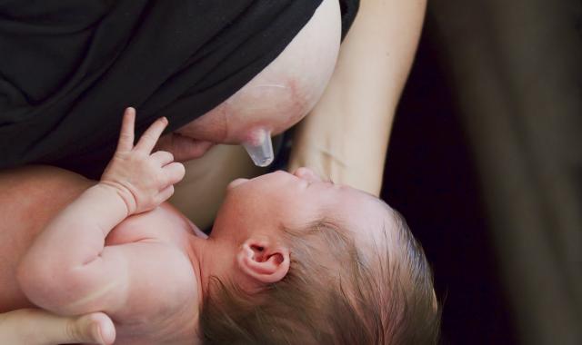 Using a nipple shield with a breastfed baby - ABM