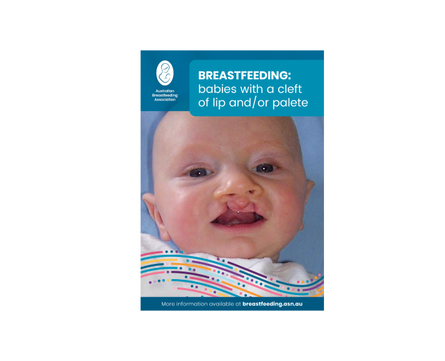 Breastfeeding babies with a cleft of lip and or palate