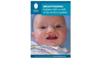 Breastfeeding babies with a cleft of lip and or palate